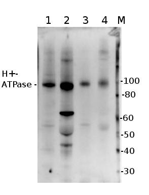 western blot using affinity purified anti-H+-ATPase antibodies 